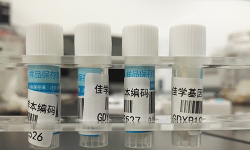 【佳學基因檢測】做Bosch-Boonstra-Schaaf視神經萎縮綜合征基因解碼、<a href=http://m.hyjhsj.com/tk/jiema/cexujishu/2021/31933.html>基因檢測</a>需要多長時間？