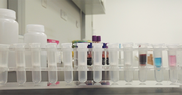 【佳學(xué)基因檢測(cè)】做<font color='red'><font color='red'>肺泡</font><font color='red'>蛋白</font></font>沉著癥基因解碼、基因檢測(cè)采用什么樣品？