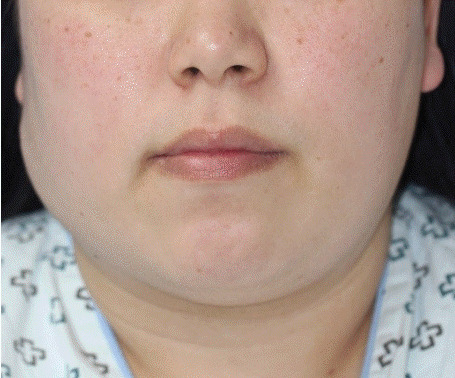 An external file that holds a picture, illustration, etc.
Object name is acfs-2019-00710f1.jpg