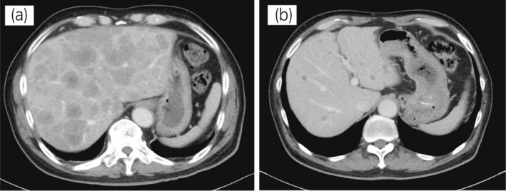 An external file that holds a picture, illustration, etc.
Object name is IJU5-6-37-g003.jpg