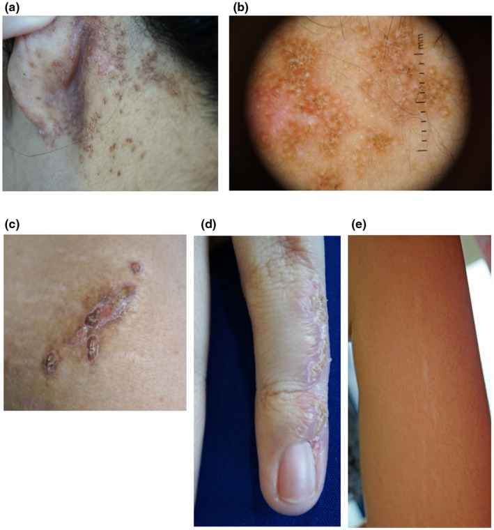 An external file that holds a picture, illustration, etc.
Object name is MGG3-10-e1848-g002.jpg