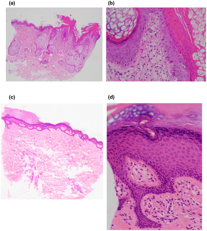 An external file that holds a picture, illustration, etc.
Object name is MGG3-10-e1848-g005.jpg